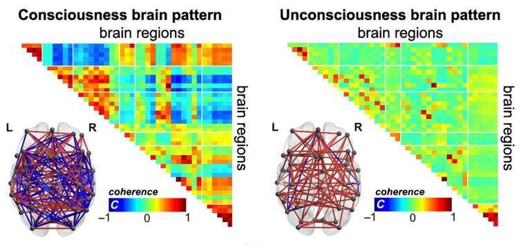 How we identified brain patterns of consciousness