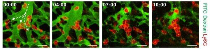 KAIST identifies the cause of sepsis-induced lung injury