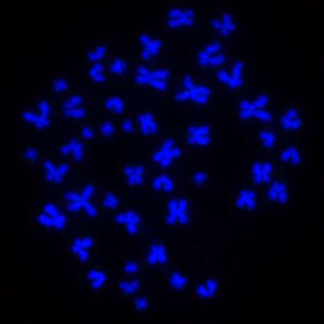 New computational tool lets researchers identify cells based on their chromosome shape