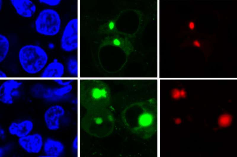 New method uses fluorescence to identify disease-causing forms of proteins