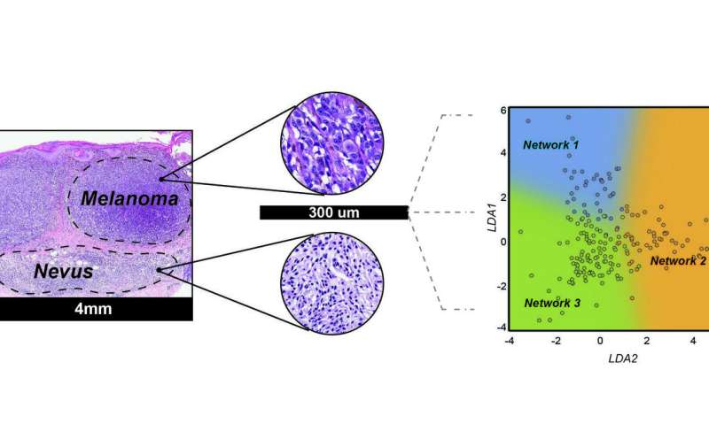 Novel strategy using microRNA biomarkers can distinguish melanomas from nevi