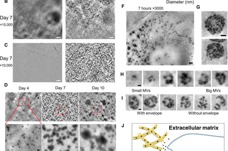 Osteoblastic lysosome plays a central role in mineralization