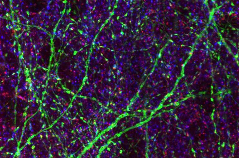 Possible link discovered between autism and formation of inhibitory synapses