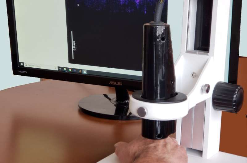 Rutgers scientist creates 'virtual biopsy' device to detect skin tumors