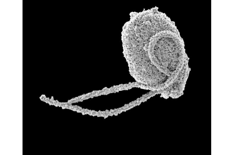 Spawn of the triffid? Tiny organisms give us glimpse into complex evolutionary tale