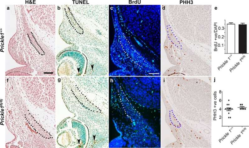 The Prickle1 gene regulates the differentiation of frontal bone osteoblasts in a new animal model
