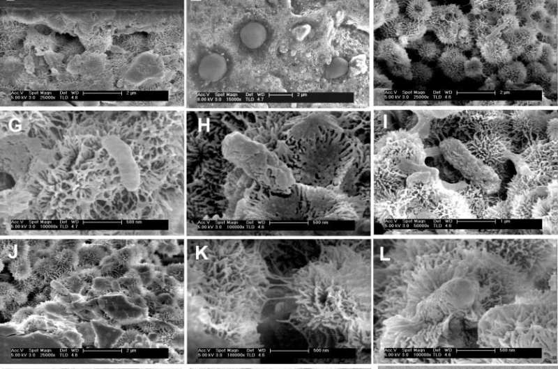Ultra-small microbes exhibit extreme survival skills in Ethiopia’s Mars-like wonderland
