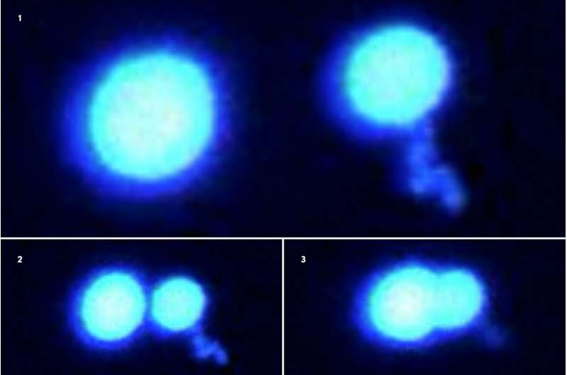 Using laser 'tweezers,' scientists grab and study tiny protein droplets