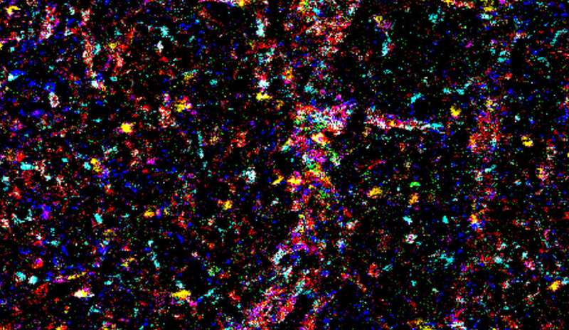 Yale researchers use immune system to attack glioblastoma