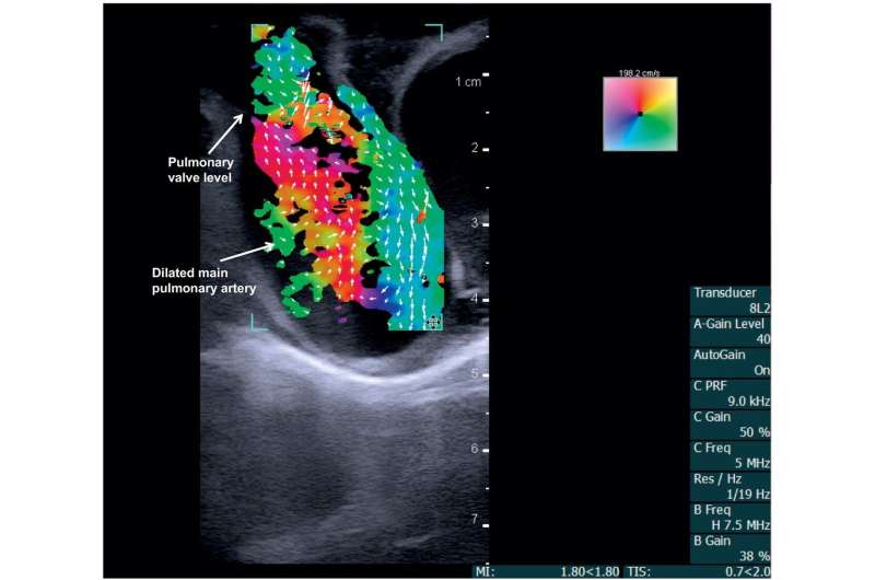 Researchers test new imaging method for first time on human patients