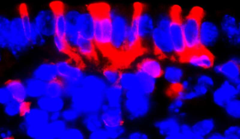Researchers identify stem cell source of key process in female reproduction