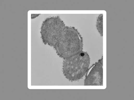 Study reveals a microbe's molecular role in Crohn&#039;s disease
