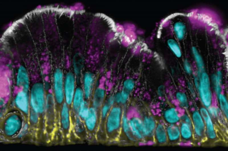 Investigating the human intestinal mucus barrier up-close and personal