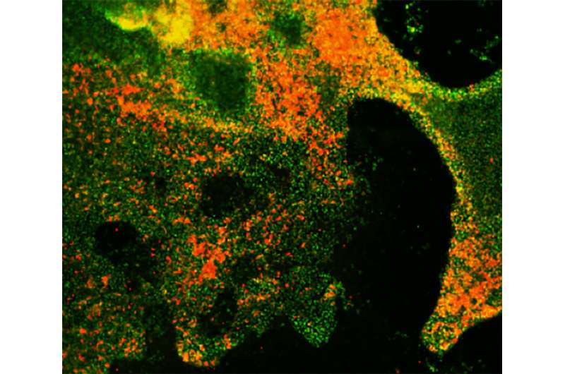 Researchers develop human cell-based model to study small cell lung cancer