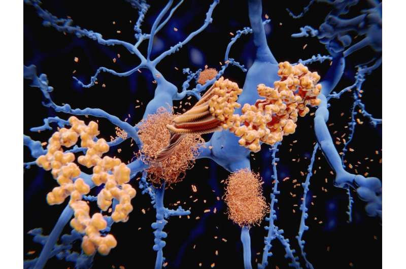 Identifying the molecular structure of one of Alzheimer's stickier culprits