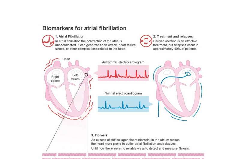 New study identifies biomarkers to predict the risk of atrial fibrillation