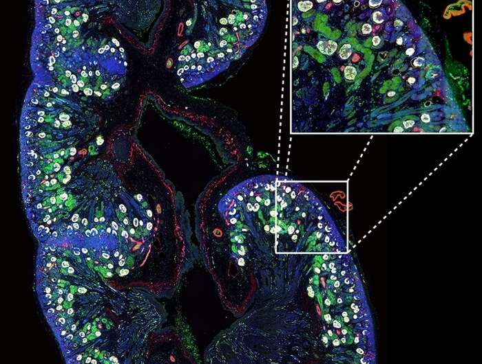 Scientists map cell types in fetal kidney