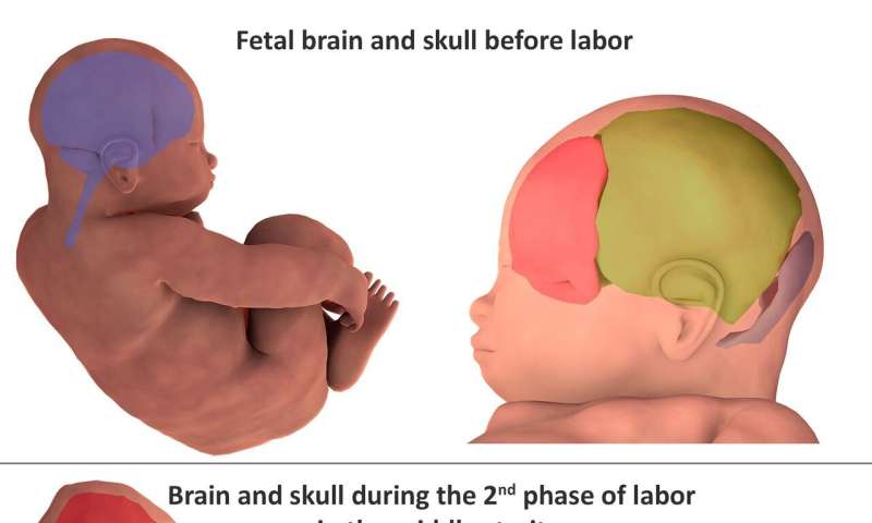 3D images reveal how infants' heads change shape during birth