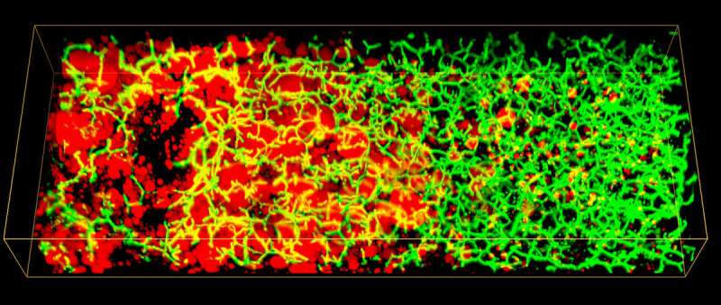 3-D model of human liver for better diagnosis