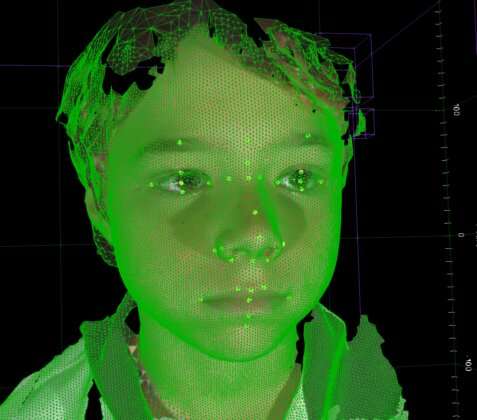 3-D technology finds tiny medical clues in children’s faces