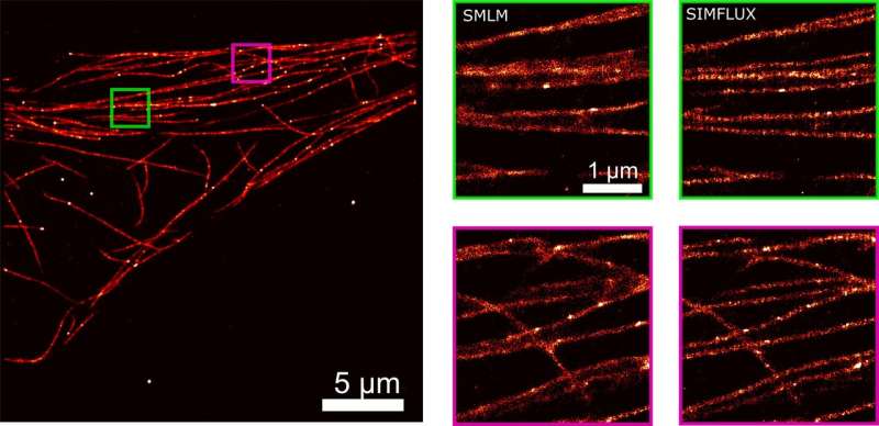 Combination of microscopy techniques makes images twice as sharp