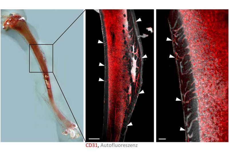 Discovery of blood vessel system in bones