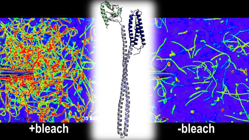New research reveals that a human stomach pathogen is attracted to bleach