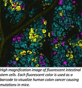 New technique visually depicts how cancer cells grow and spread in colon tissue