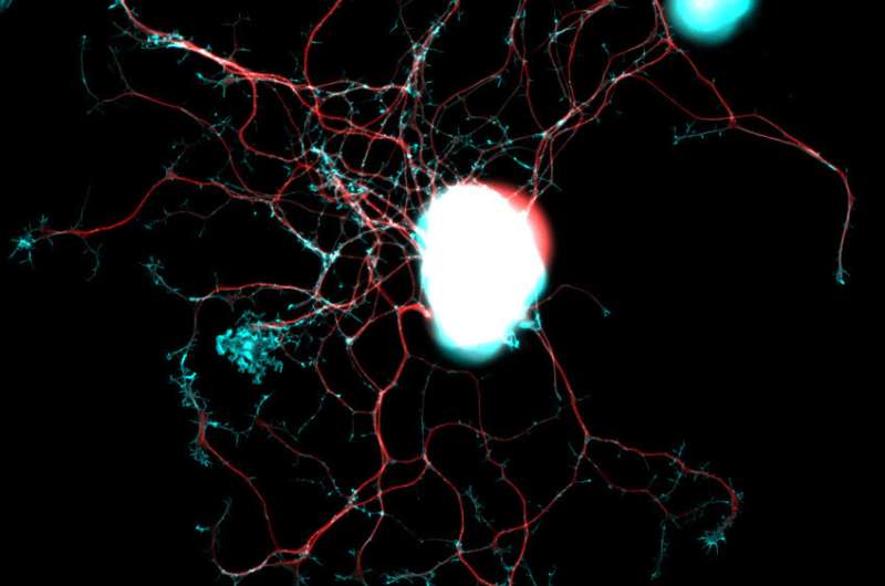 Researchers identify key proteins for the repair of nerve fibers