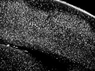 Researchers controlled the behavior in a mouse's brain with single-cell precision