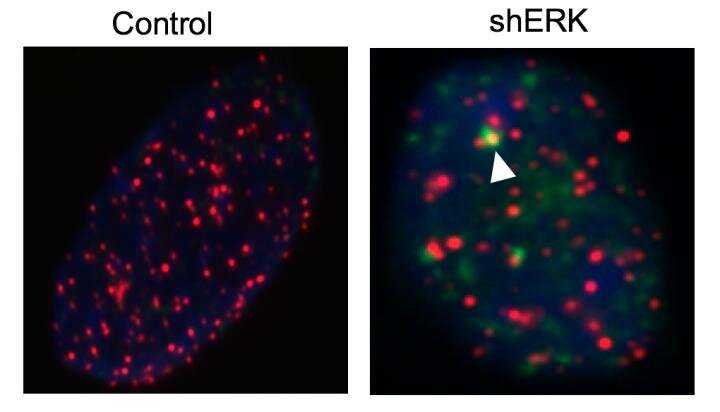 CNIO研究人员发现有效的药物组合用于小鼠胶质母细胞瘤