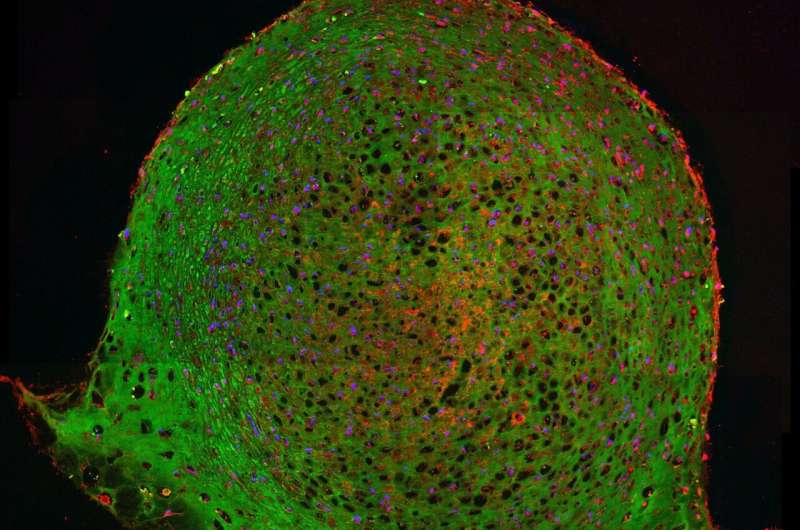 Stem cells regulate their fate by altering their stiffness