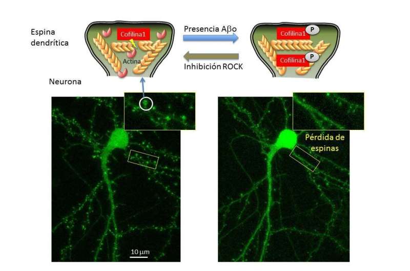 Neuronal cytoskeletons involved in Alzheimer's disease