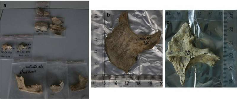 **Skull fragments suggest Iron Age Celts in southern France tried to embalm severed heads