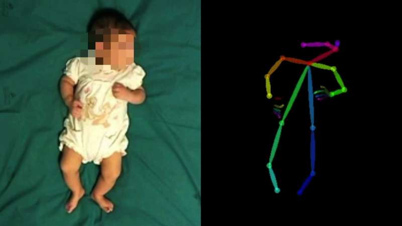 Artificial intelligence identifies key patterns from video footage of infant movements