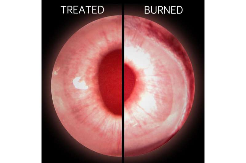 A soft spot for stem cells helps cornea healing