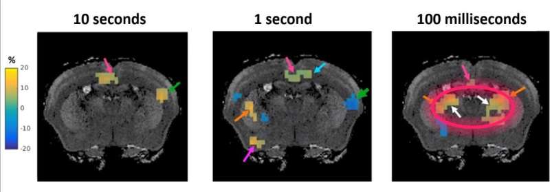Fundamentally new MRI method developed to measure brain function in milliseconds