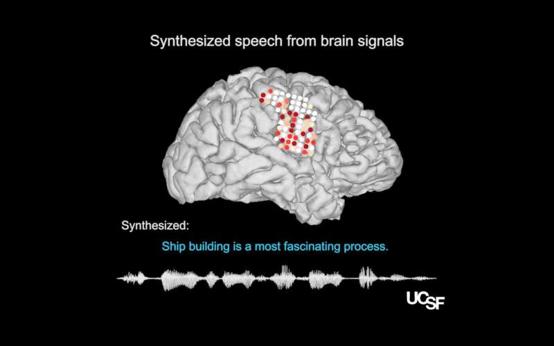 从大脑生成的合成语音录音
