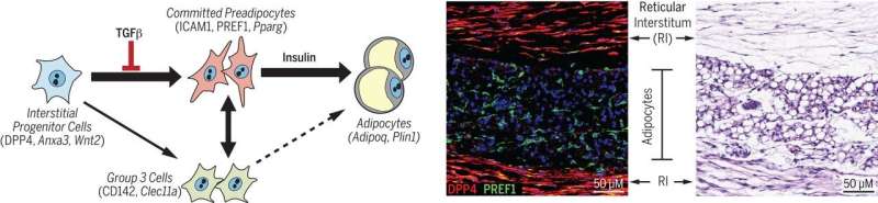 Three new classes of obesity-related adipocyte progenitor cells identified