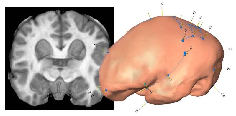Brain, shape and fossils