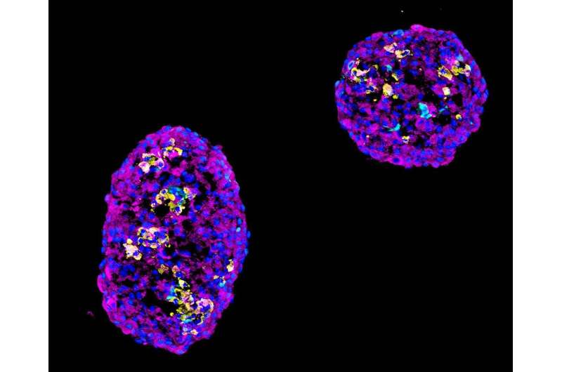 Research boosts the yield of insulin-producing cells for diabetes therapy