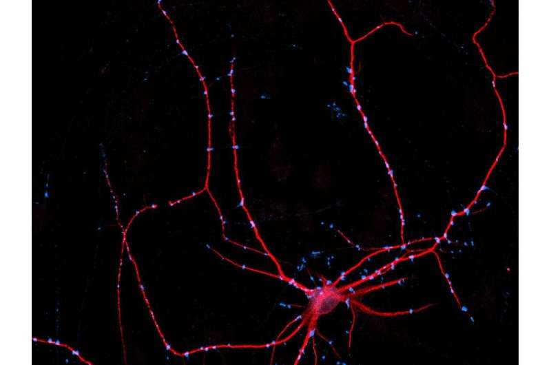 A nerve cell serves as a “single” for studies