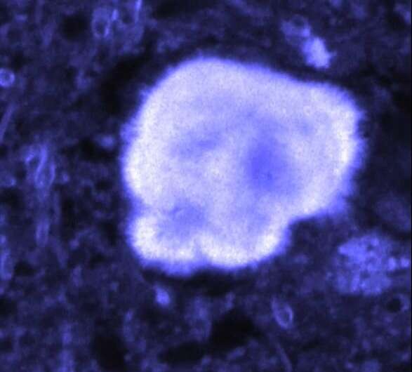 Amyloid fibrils lit with near-infrared radiation found to emit a dim, near-infrared signal