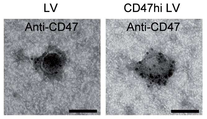 Researchers find adding a protein to lentiviral vectors protects them from immune system