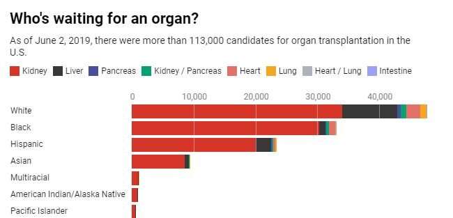 Minorities face more obstacles to a lifesaving organ transplant