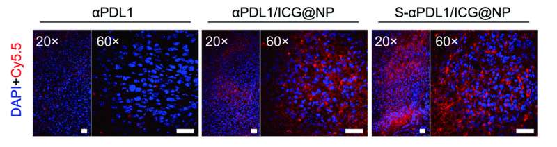 Elegant antibody nanoparticles override immunological tolerance of tumors