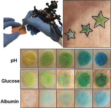 Dermal tattoo sensors for the detection of blood pH change and metabolite levels