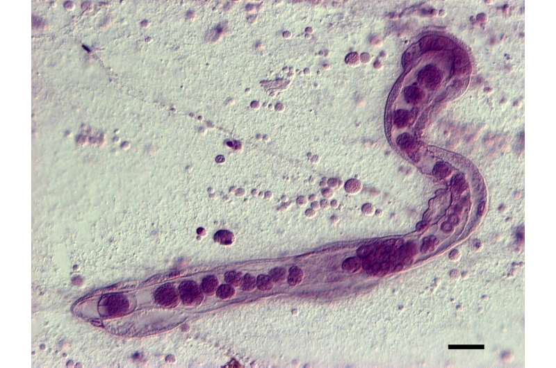 Decoding the complex life of a simple parasite