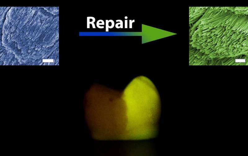 A way to repair tooth enamel