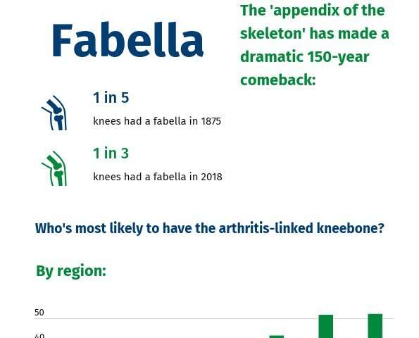 Region, age, and sex decide who gets arthritis-linked 'fabella' knee bone